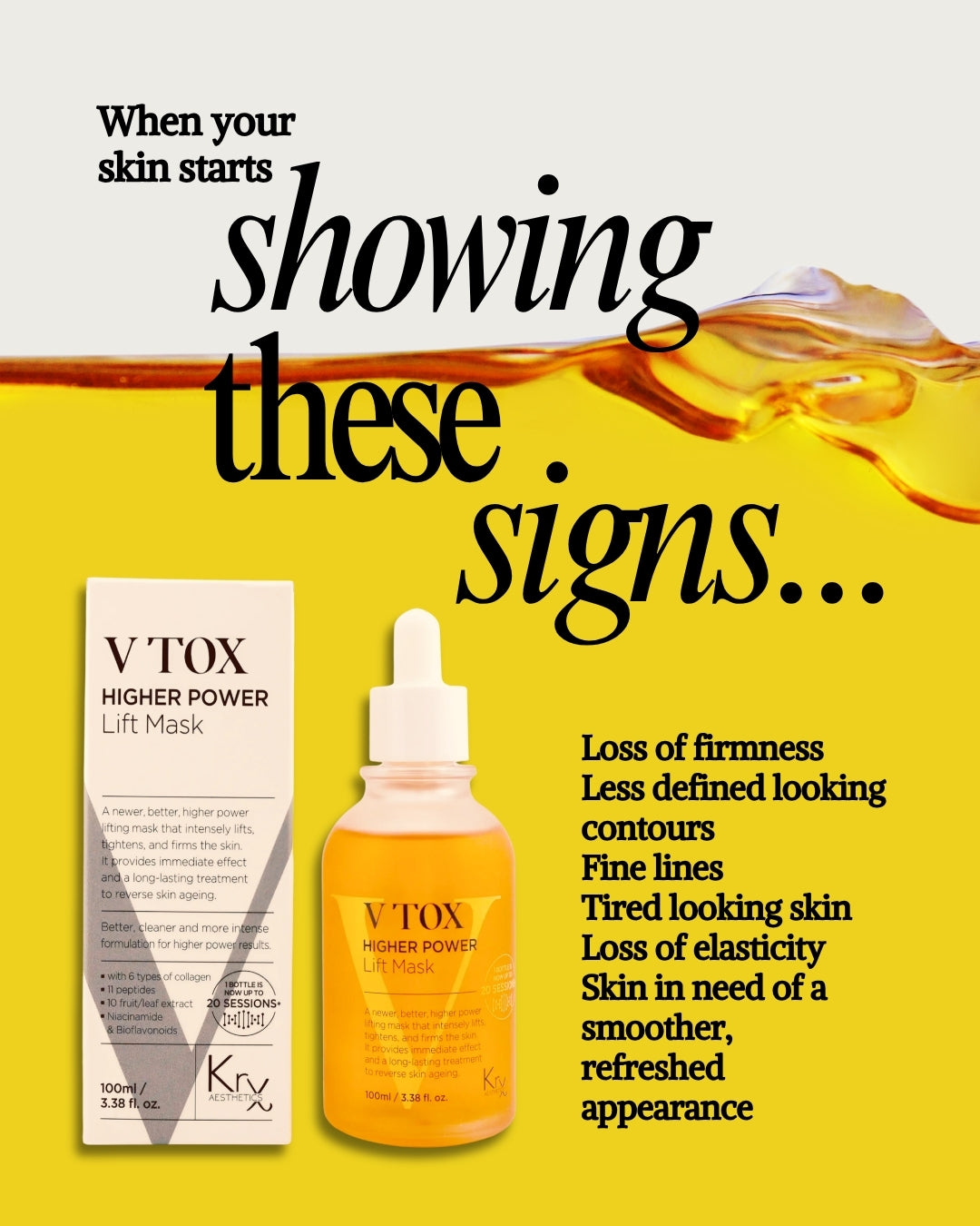 KRX V-TOX promotional photograph 3
