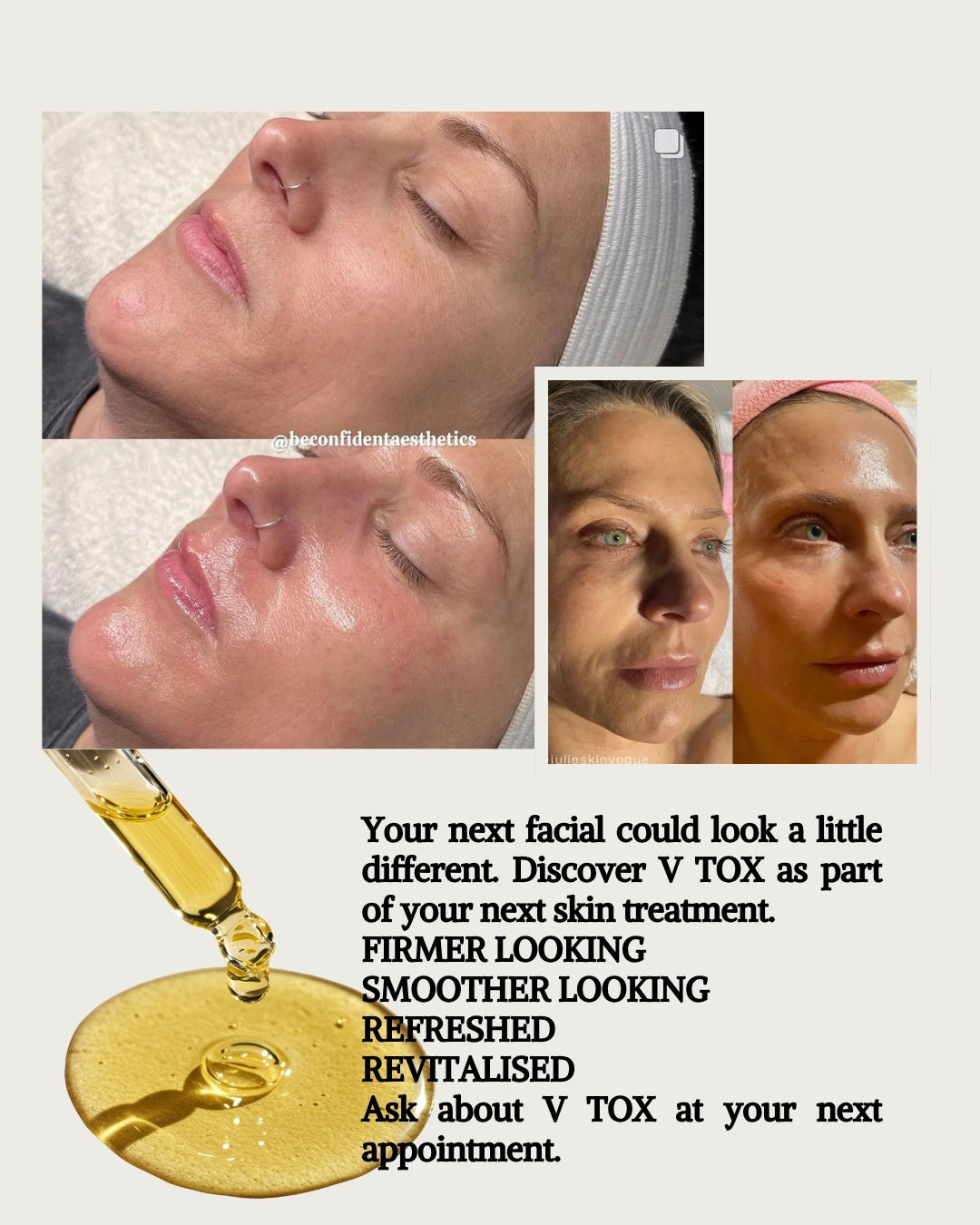 KRX V-TOX promotional photograph 4